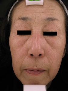 case_face2_031