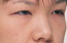 case_face4_003