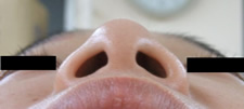 case_face4_005