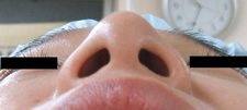 case_face4_006