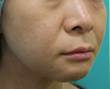 case_face4_007