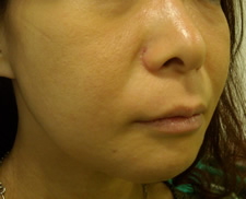 case_face4_008