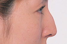 case_face4_009