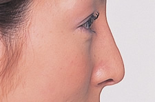 case_face4_010