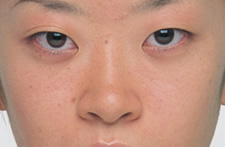 case_face4_013