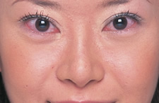 case_face4_014