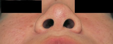 case_face4_015