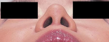 case_face4_016