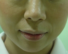 case_face5_001