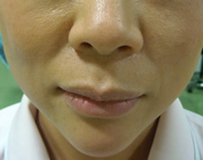 case_face5_002