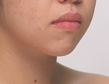 case_face5_003