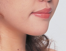 case_face5_004