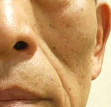 case_face5_005