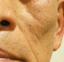 case_face5_006