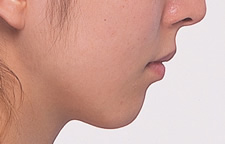 case_face5_007