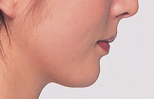 case_face5_008