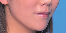 case_face5_010