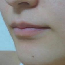 case_face6_001