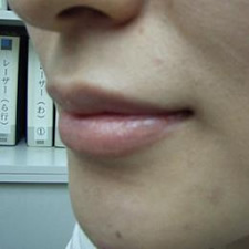 case_face6_002
