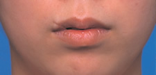 case_face6_003