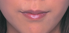 case_face6_004