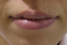 case_face6_007
