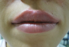 case_face6_008