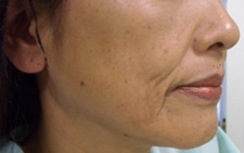 case_face_013