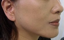 case_face_014