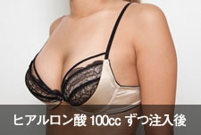 case_houkyou_018