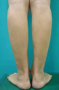 case_shibo2_006