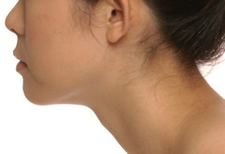 case_shibo2_008