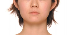case_shibo2_011