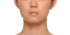 case_shibo2_012