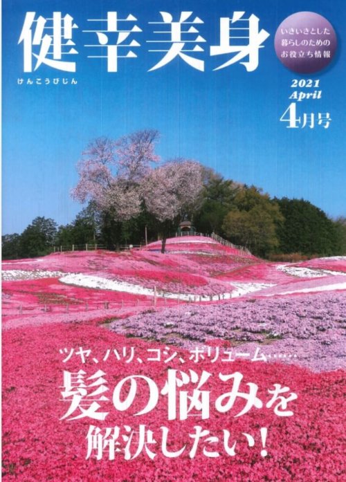 雪印の機関紙に女性薄毛のついて解説しました！