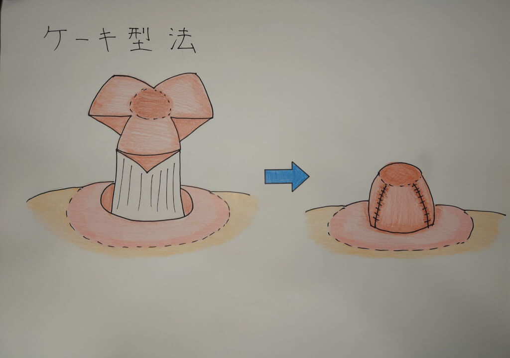 ウキチク問題の解消方法