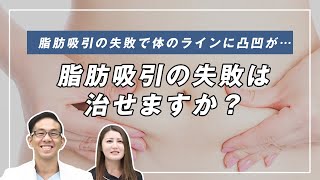 脂肪吸引で凸凹に！？脂肪吸引で失敗しない方法とは？