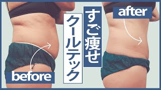 リバウンドしない!?切らない痩身治療クールテック!