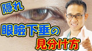理想の二重にならない人は眼瞼下垂かも!?