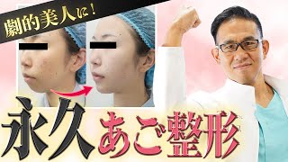 あごプロテーゼ手術するだけで、美人度が上がる!?