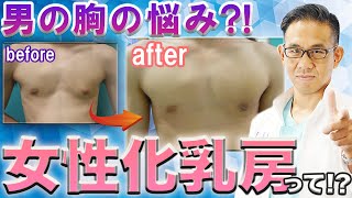 男性なのに胸が膨らむ！女性化乳房とは？