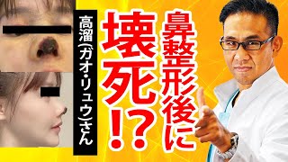 鼻整形後に鼻が壊死!?中国の女優に起きた事とは？
