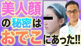 顔のヒアルロン酸注入で期待できる効果とは？