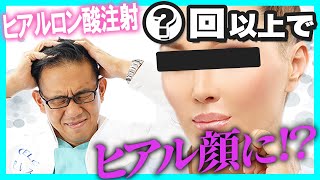 ヒアルロン酸入れすぎ注意!?ヒアル顔とは?