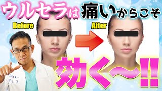 ウルセラは痛ければ痛いほど効く？