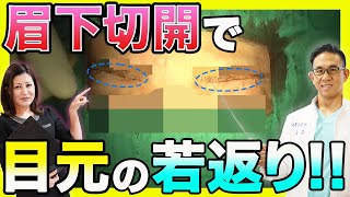 目元が若返る眉下切開手術を動画を見ながら医師が解説!!