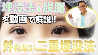 外れない二重手術!埋没法と脱脂法とは?