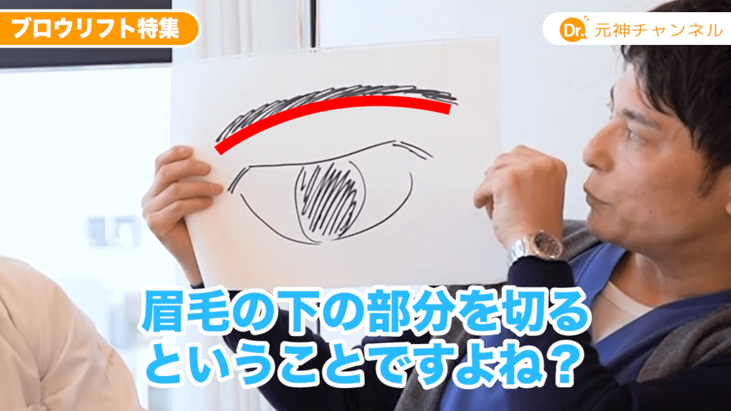 上まぶたのたるみの動画解説