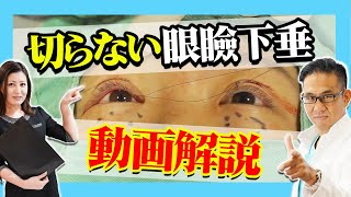 切らない眼瞼下垂を手術動画を見ながら医師が解説