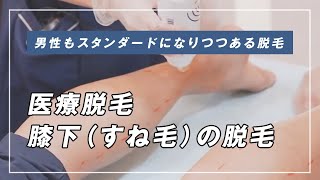 海外では当たり前!?医師が自ら医療脱毛を受けてみた!